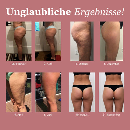 LUMIVE™ 3D Kompressionsleggings
